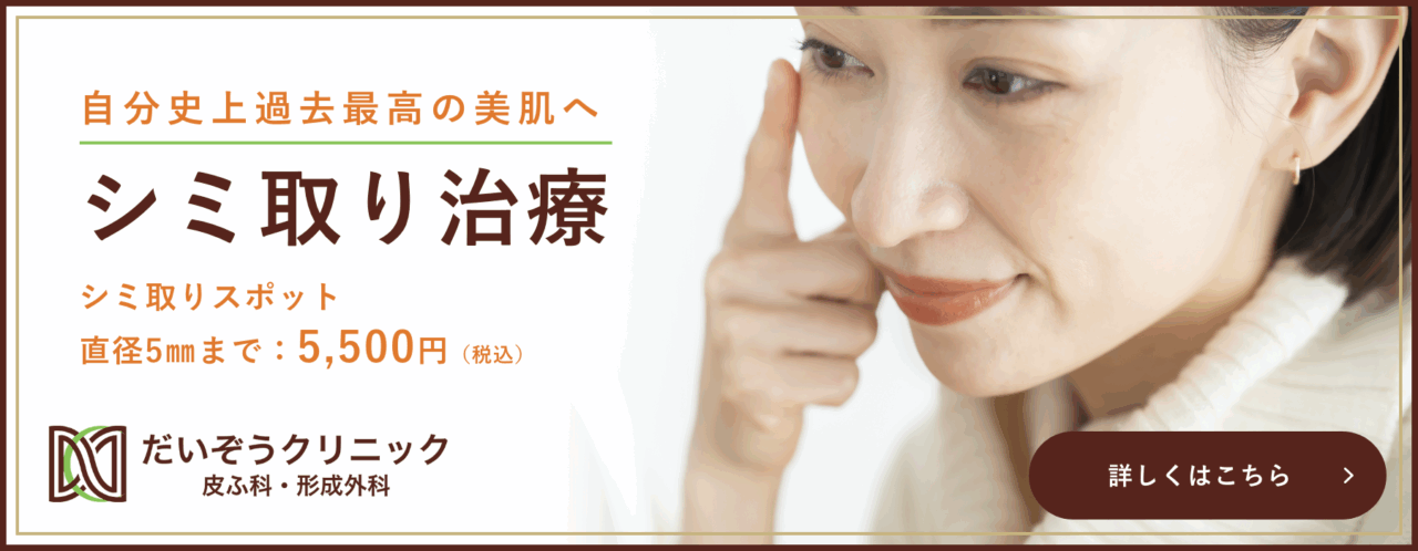 シミ取り治療について詳しくはこちら