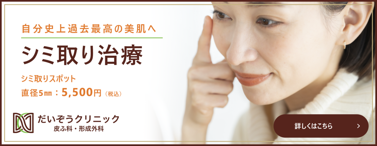 シミ取り治療について詳しくはこちら