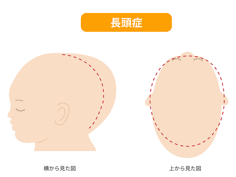 富山県高岡市・射水市・氷見市でヘルメット外来を提供している形成外科・皮膚科・美容皮膚科のだいぞうクリニックイメージ図
